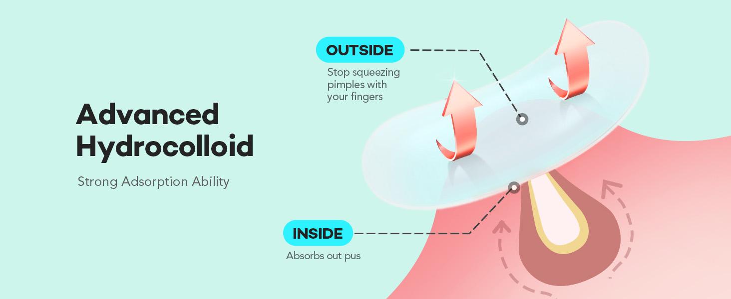 LitBear Large Pimple Patches for Face (6 Sizes 401 Patches), Big Hydrocolloid Acne Patches, XL Hydrocolloid Bandages for Body, Cheek, Forehead, Chin, Full Face, Back, Nose, Acne patch & Pimple patch LitBear Large Pimple Patches for Face (6 Sizes 401 Patches), Big Hydrocolloid Acne Patches, XL Hydrocolloid Bandages for Body, Cheek, Forehead, Chin, Full Face, Back, Nose, Acne patch & Pimple patch