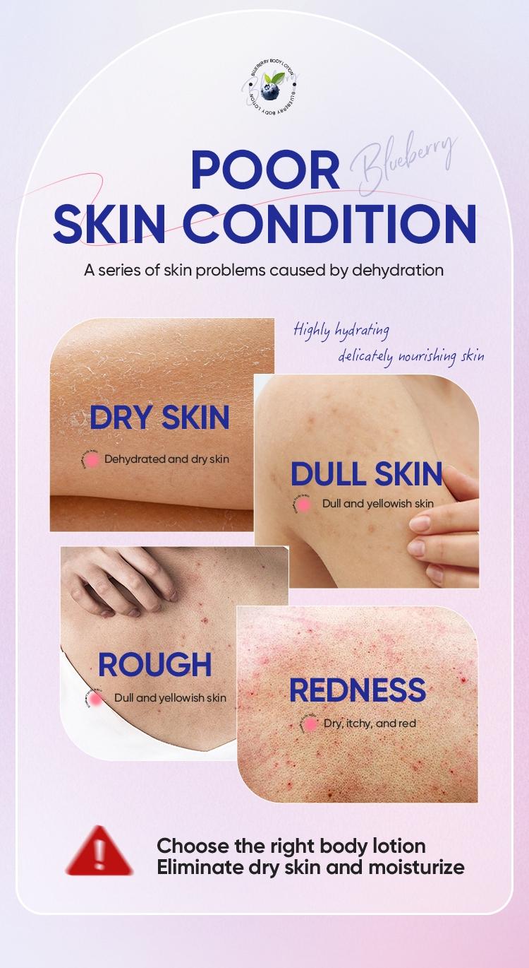 Blueberry Body Lotion 100g Moisturizing Deep Nourishing Brightening Scented Full-Body Skincare for Dry Skin