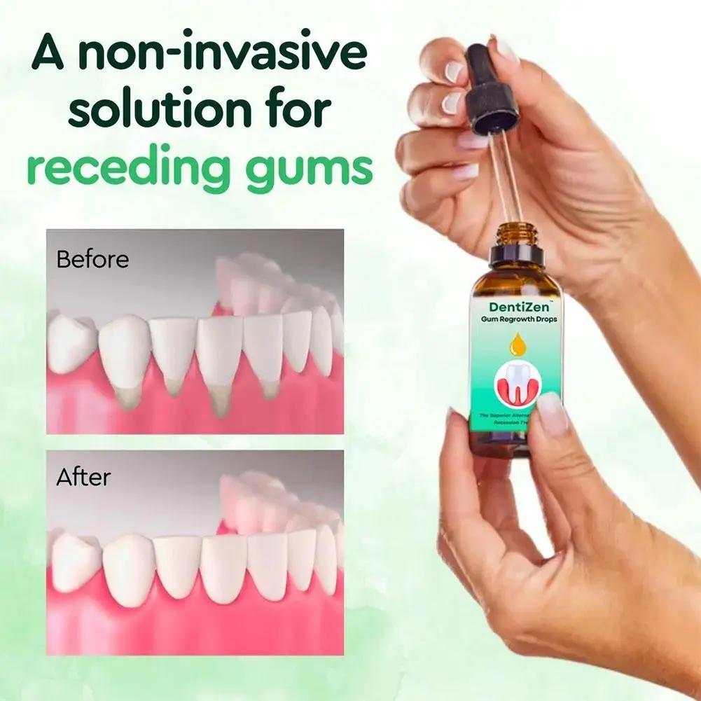Gum Repair Drops Relieve Receding Gingival Swelling Gum Cleaning Care Oral Periodontal Hygiene Remove Yellow Remove Stain Gum Repair Drops Relieve Receding Gingival Swelling Gum Cleaning Care Oral Periodontal Hygiene Remove Yellow Remove Stain