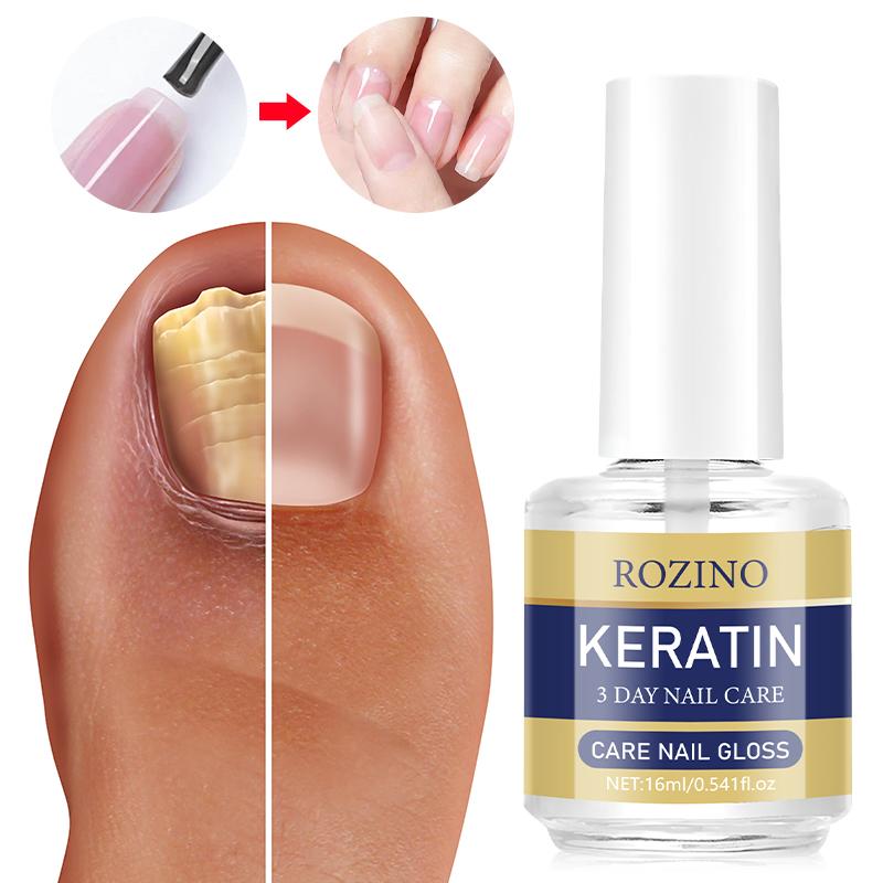 ROZINO 3 Days Nail Care Keratin Amino Acid Formula for Superior Nail Nourishment Lightweight Moisture Boosting Daily Manicure 16ml ROZINO 3 Days Nail Care Keratin Amino Acid Formula for Superior Nail Nourishment Lightweight Moisture Boosting Daily Manicure 16ml