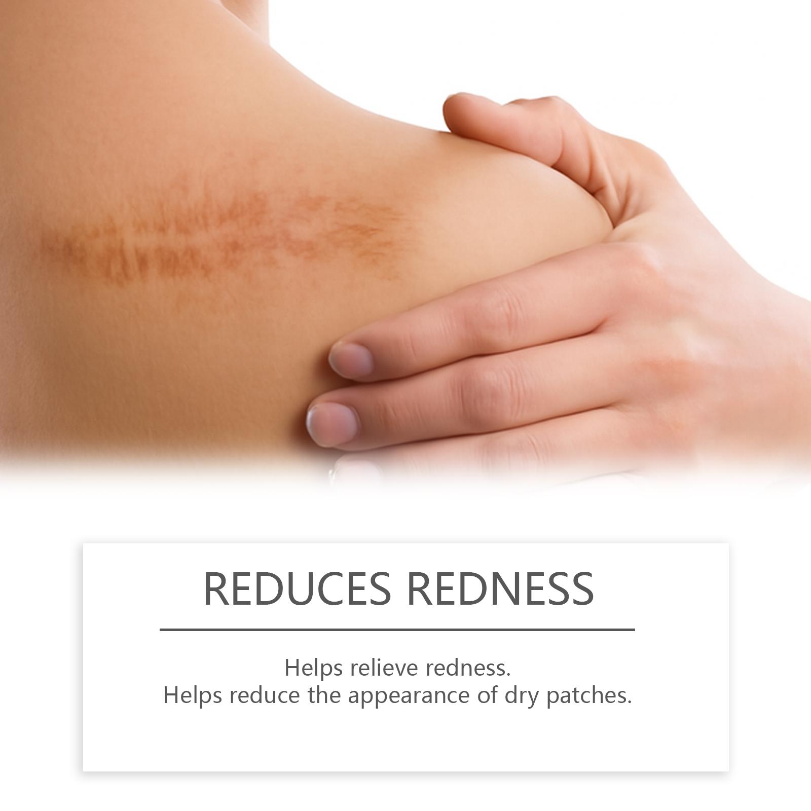 Skin Scar Moisturizing Care Stick, Nourishing Facial Body Skin Scar Appearance Smooth Soft Daily Care Cream, Essential Skincare Routine