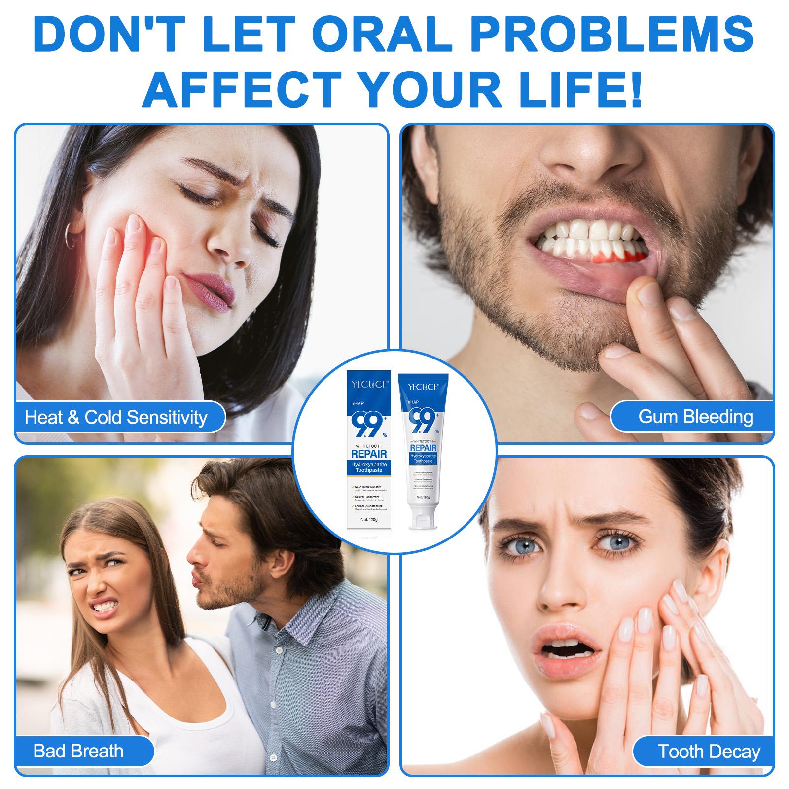 Nano Hydroxyapatite Remineralizing Toothpaste for Sensitive Teeth Care, Fluoride-Free Fresh Flavor Balm, Protects Enamel, Promotes Confidence Smile