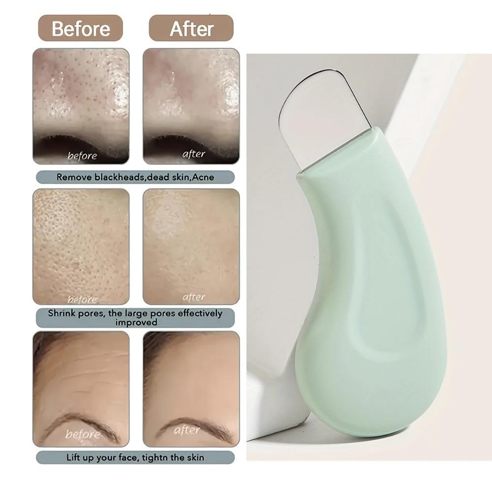 Blackhead Spatula Blackhead and Whitehead Removal Tool for Nose and Face - Facial Pore Cleaner Skin Care Tools for Women