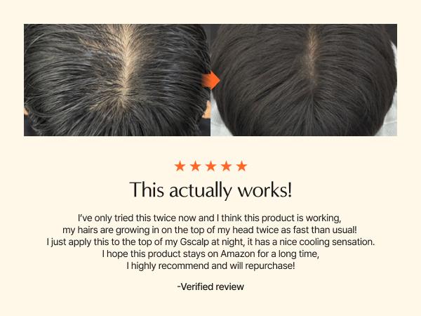 Lilyeve Growturn Hair Growth Serum with Built in Brush for Hair Growth & Thickening Lilyeve Growturn Hair Growth Serum with Built in Brush for Hair Growth & Thickening