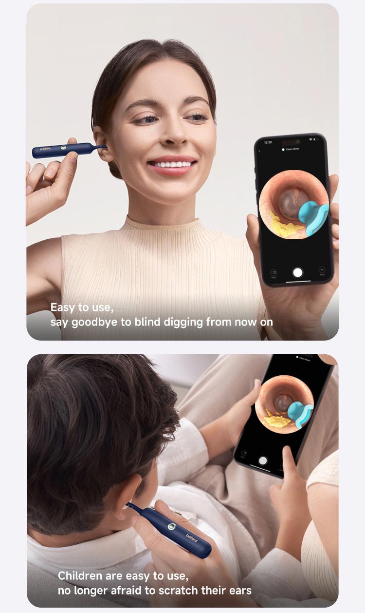 【For Pros】Smart Ear Cleaning Tool, 1 Box Ear Wax Removal Tool with 12pcs Tip, Portable Ear Wax Cleaner, Ear Wax Cleaning Kit, Ear Waxing Cleaning,  Ear Wax Removal Kit Earwax Remover ear wax removal tool