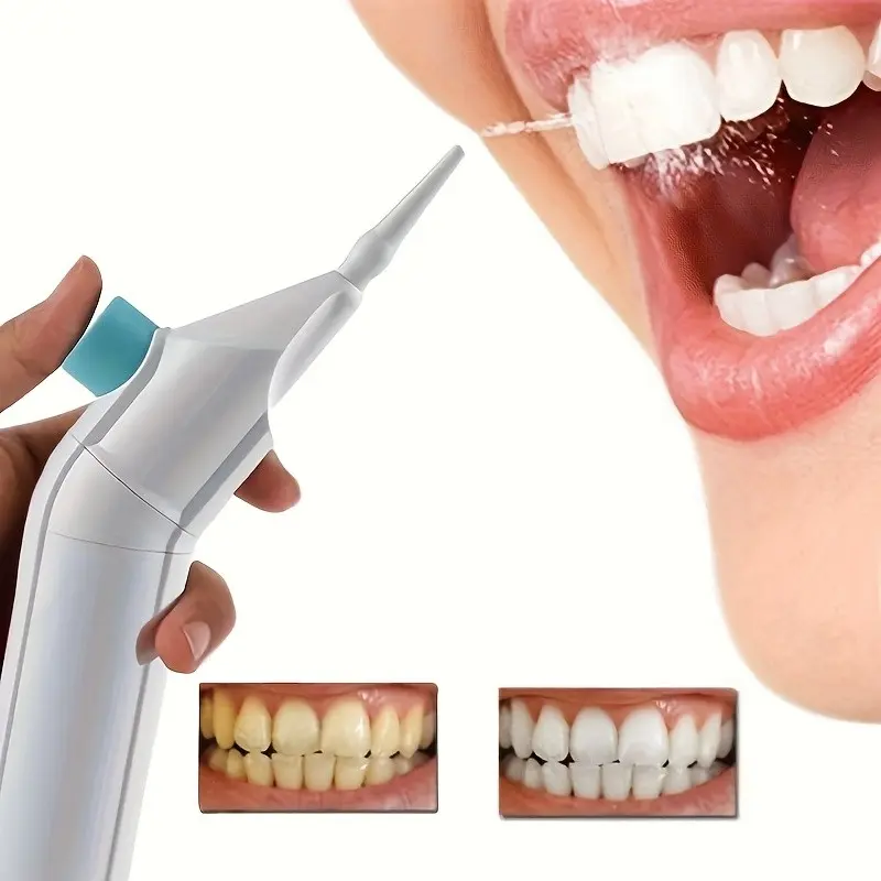 Portable Manual High-Pressure Flosser, ABS Material, High-Pressure Pulse Technology, Push-Button Control, Detachable Nozzle, for Oral Care, Dental Cleaning, Travel and Home Use, No Electric Drive Required.