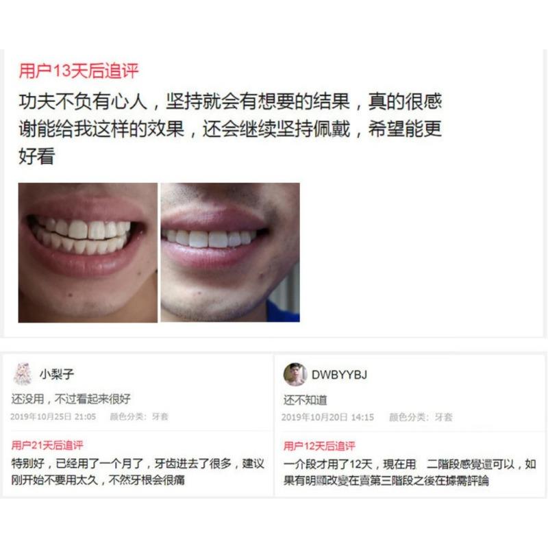 Silicone orthodontic braces Product with Storage Case, Comfortable to Wear, Safe to Use, Suitable for Both Men and Women