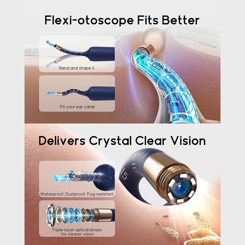 Bebird Earsight Plus D39R Ear Wax Removal Tool Camera Flexible Ear Otoscope Visual Picker Tweezers FSA HSA Eligible Item Ear Cleaning Kit for Family