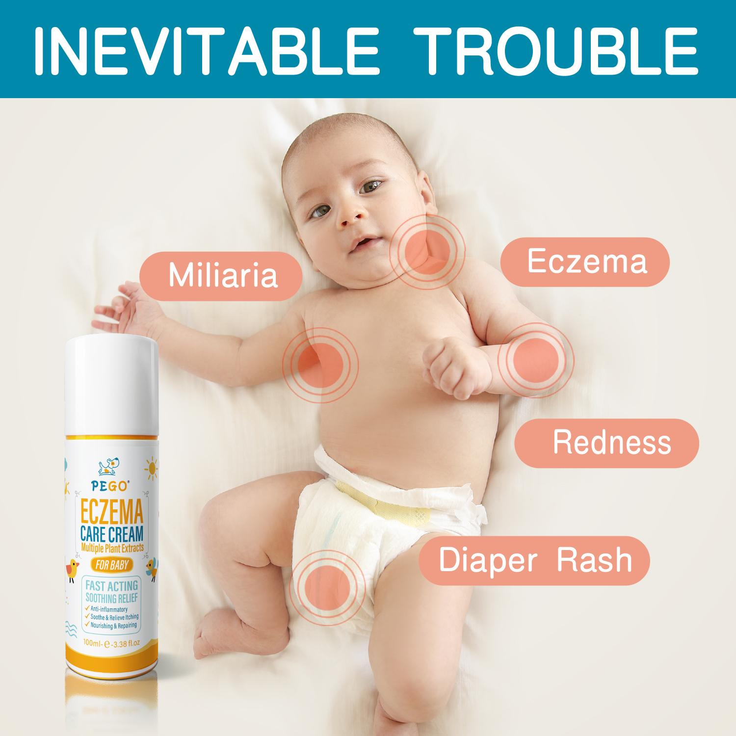 Baby Eczema Cream - Kids Eczema Therapy & Relief Body Cream, Nourishing Skin Protectant for Dry, Itchy Skin, Hypoallergenic,baby rash cream face,3.38oz/100ml