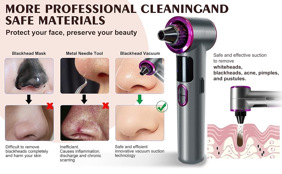 2026 Advanced Pore Vacuum Blackhead Remover with Heating,Blackhead Extractor with 3 Adjustable Suction Levels 9 Modes, 5 Probes.Blackhead Remover Tools for Women and Men