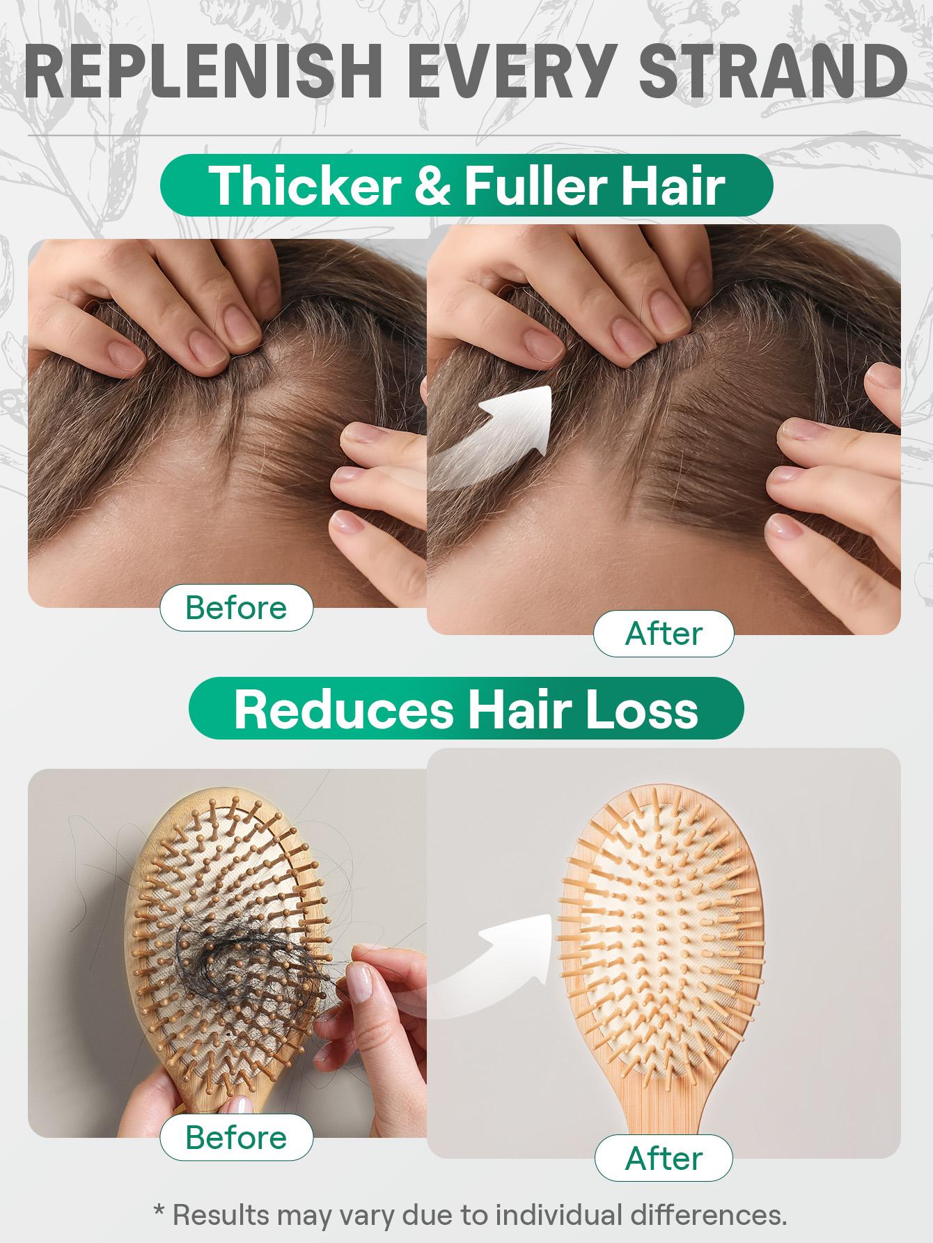 SHEGLAM HAIR Rosemary Hair And Scalp Oil -15ml/0.5Fl Oz,Hair Care Essential Oil,Rosemary Hydrating Oil Serum,Balance Scalp Sebum,Soothe Dry Scalp,Increase Shine & Elasticity,Nourish Hair Follicles,Enriched With Rosemary Oil-Effortlessbeauty-Scalphealth