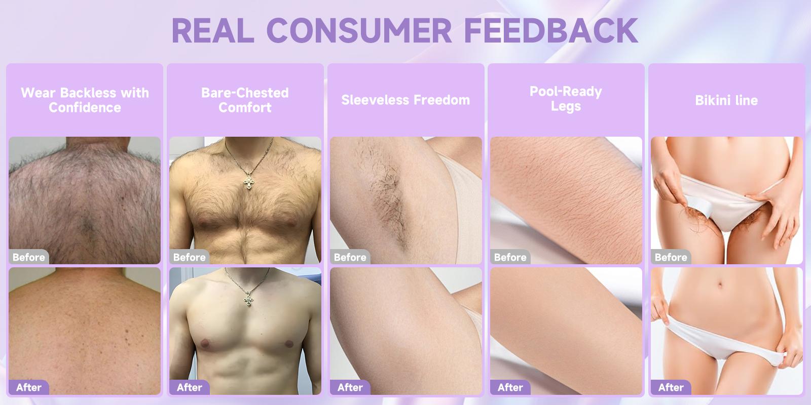 PHOFAY Painless Hair Removal Cream for Women & Men - Gentle Moisturizing Formula to Remove Hair Effortlessly, Suitable for Legs, Arms & Body, No Stubble, Flawless Smooth Finish