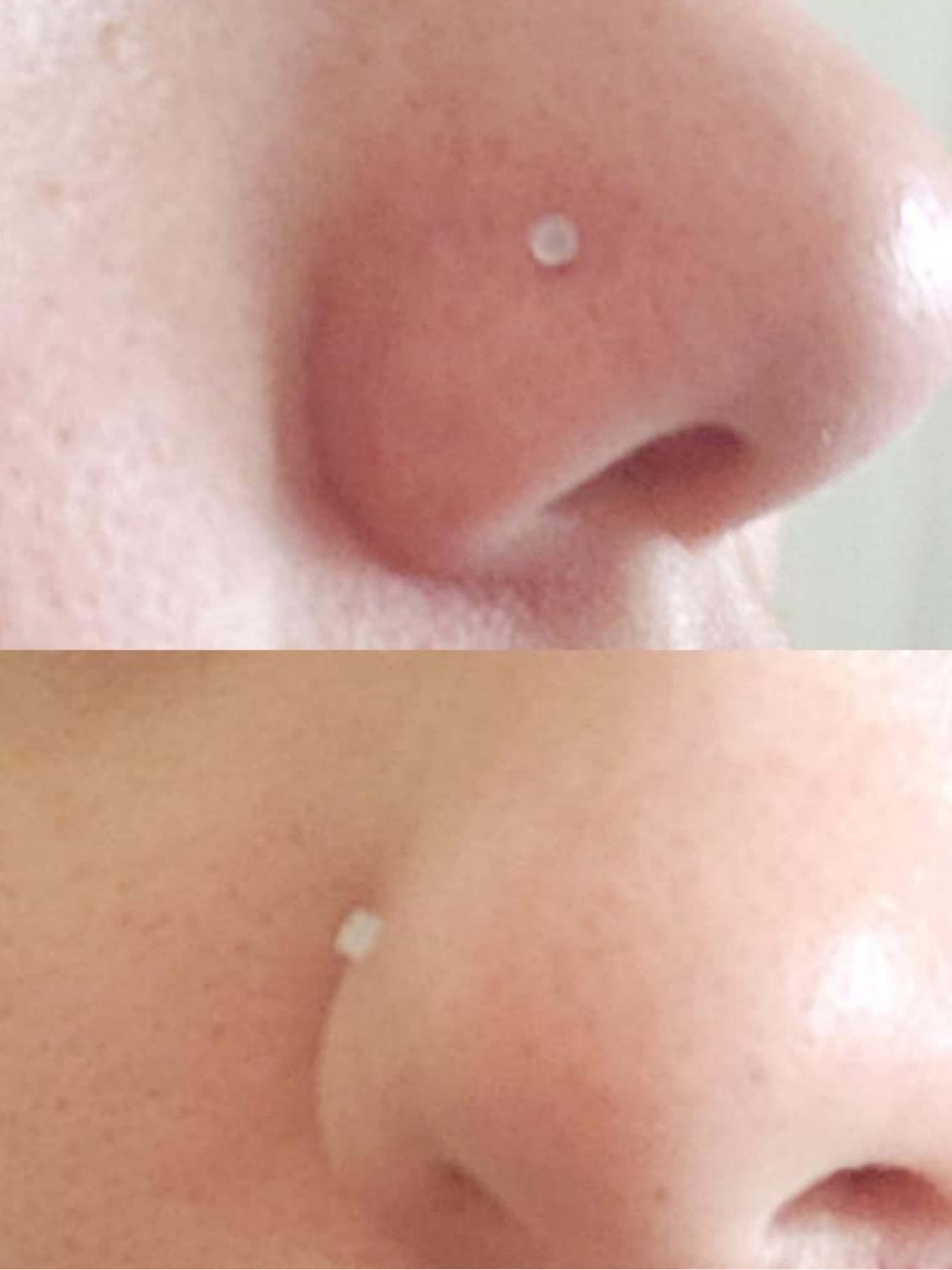 Clear Nose Rings & Studs - Plastic Nose Piercing Retainers - 16g, 20g - Clear Cartilage Earrings & Lip Piercing Retainer