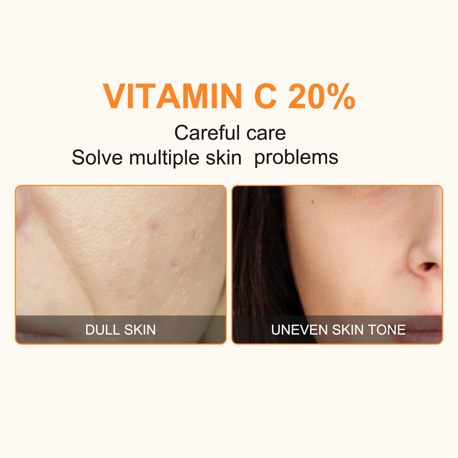 Elbbub Vitamin C Facial Serum 60ML, Stable VC Derivative, Inhibits Melanin, Brightens Skin, Reduces Acne Marks, Gentle Whitening, Non-Irritating