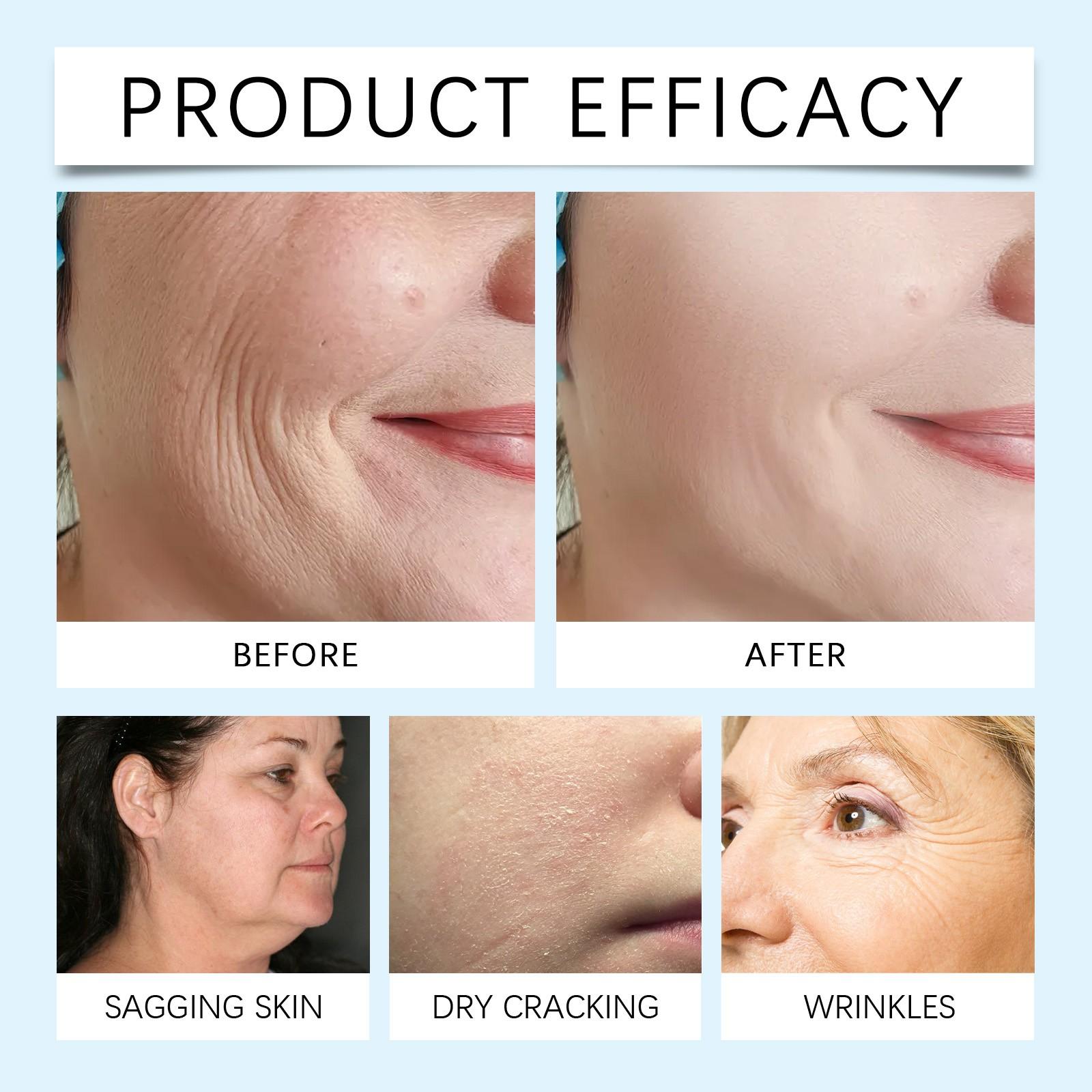 Ouhoe Body Care Cream, Moisturizing and Hydrating, Improves Skin Elasticity, Nourishes and Anti-Wrinkle, Skincare Body Lotion