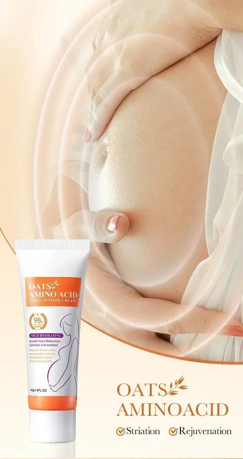 Stretch Marks Permanent Removal Cream Eliminate Body Belly Stretch Marks Swelling Marks Remove Skin Cracks Repair Firming Care