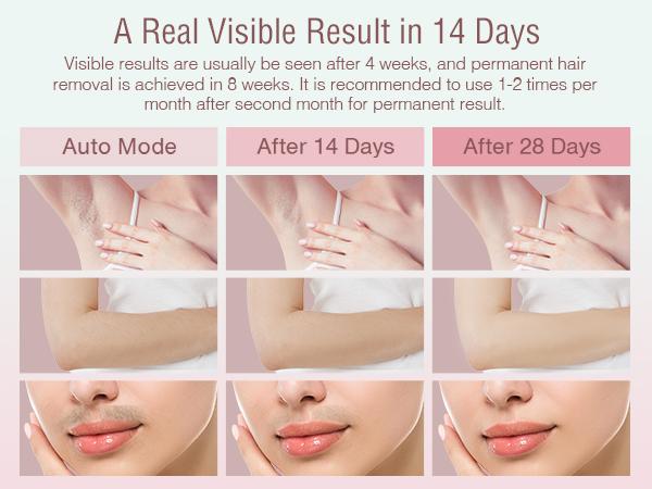 Laser Hair Removal , Painless IPL Laser Hair Removal Device At Home Hair Remover Machine for Women Men Electrolysis Permanent Epilator on Face Body Depilation