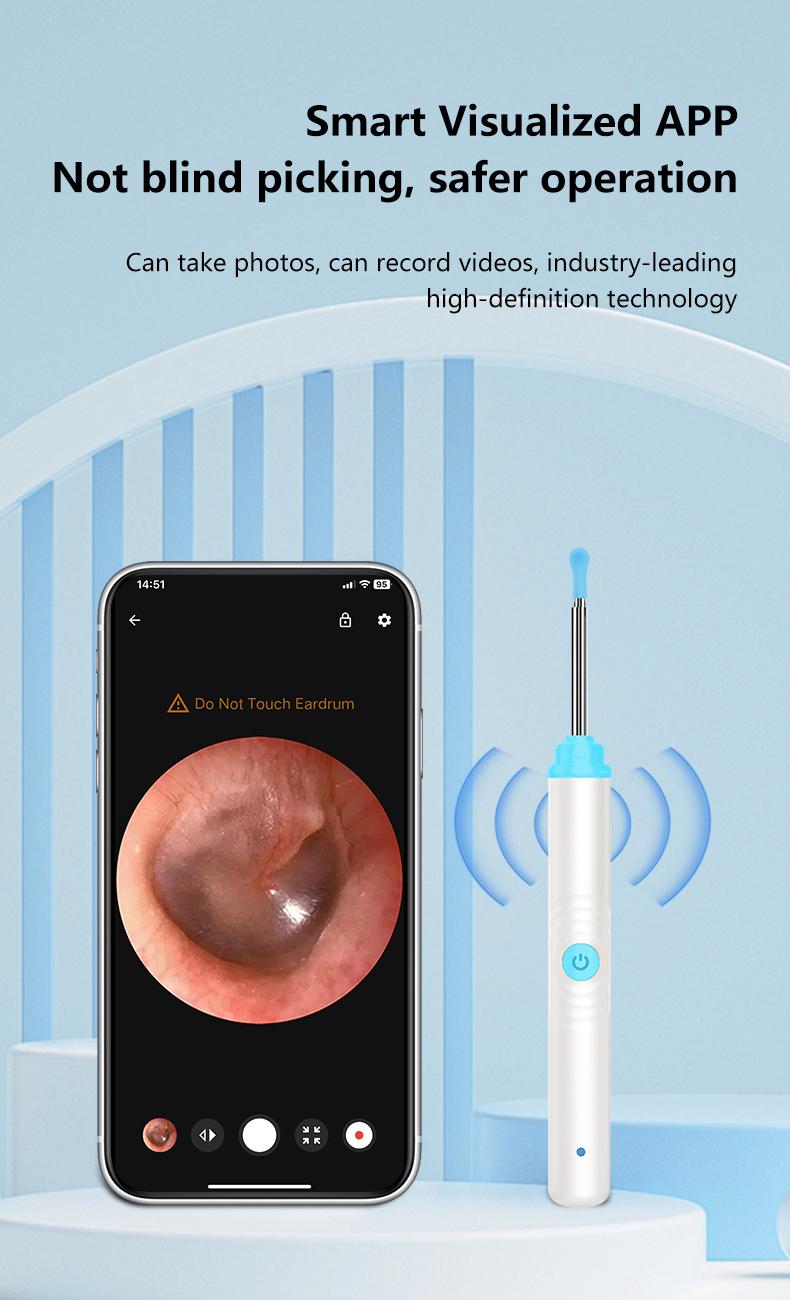 Silicone Ear Hygiene Set, HD Visual Earwax Removal Tool with Camera, 1296P HD Camera Ear Cleaner, Compatible with iPhone and Android Phones, Springtok, Spring Gift Set