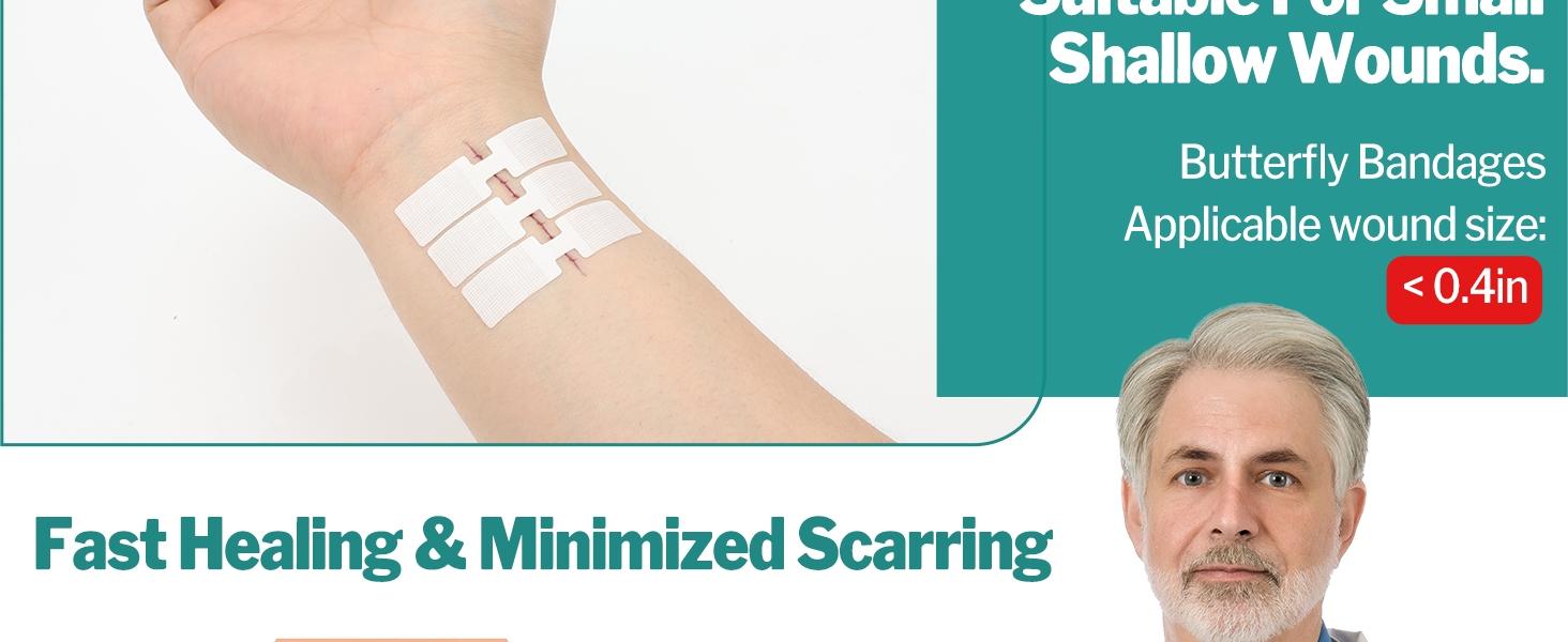 Sanke Rescue 14/28 Pack Wound Closure Strips Zipper Bandages Emergency Laceration Closure Kit Repair Wounds Closures Device