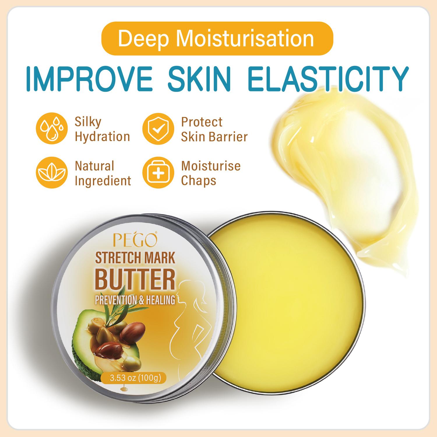 Stretch Mark Butter - Organic Belly Butter for Pregnancy and Nursing - Repair Stretch Marks and Scars - Shea Butter & Vitamin E Rich Formula, Paraben, Phenoxyethanol Free, 3.53 Oz/100g