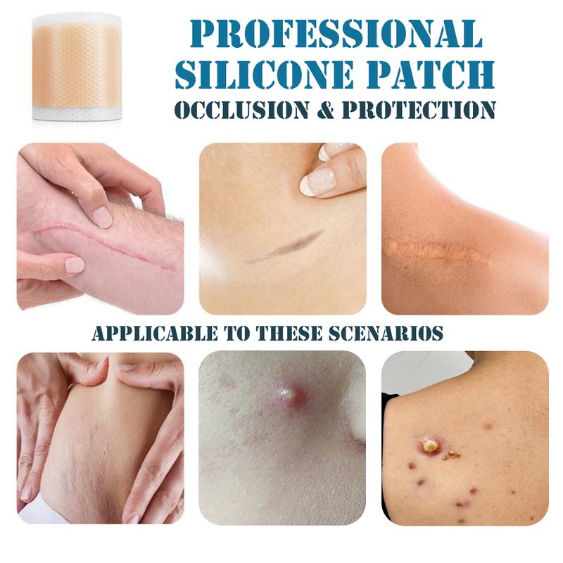 Reusable Silicone Patches (1.6" x 60" Roll, 1.5 Meters) – Breathable and Waterproof, Protects Skin from Friction - Suitable for Acne, Chest, Makeup, Concealment, and More Uses