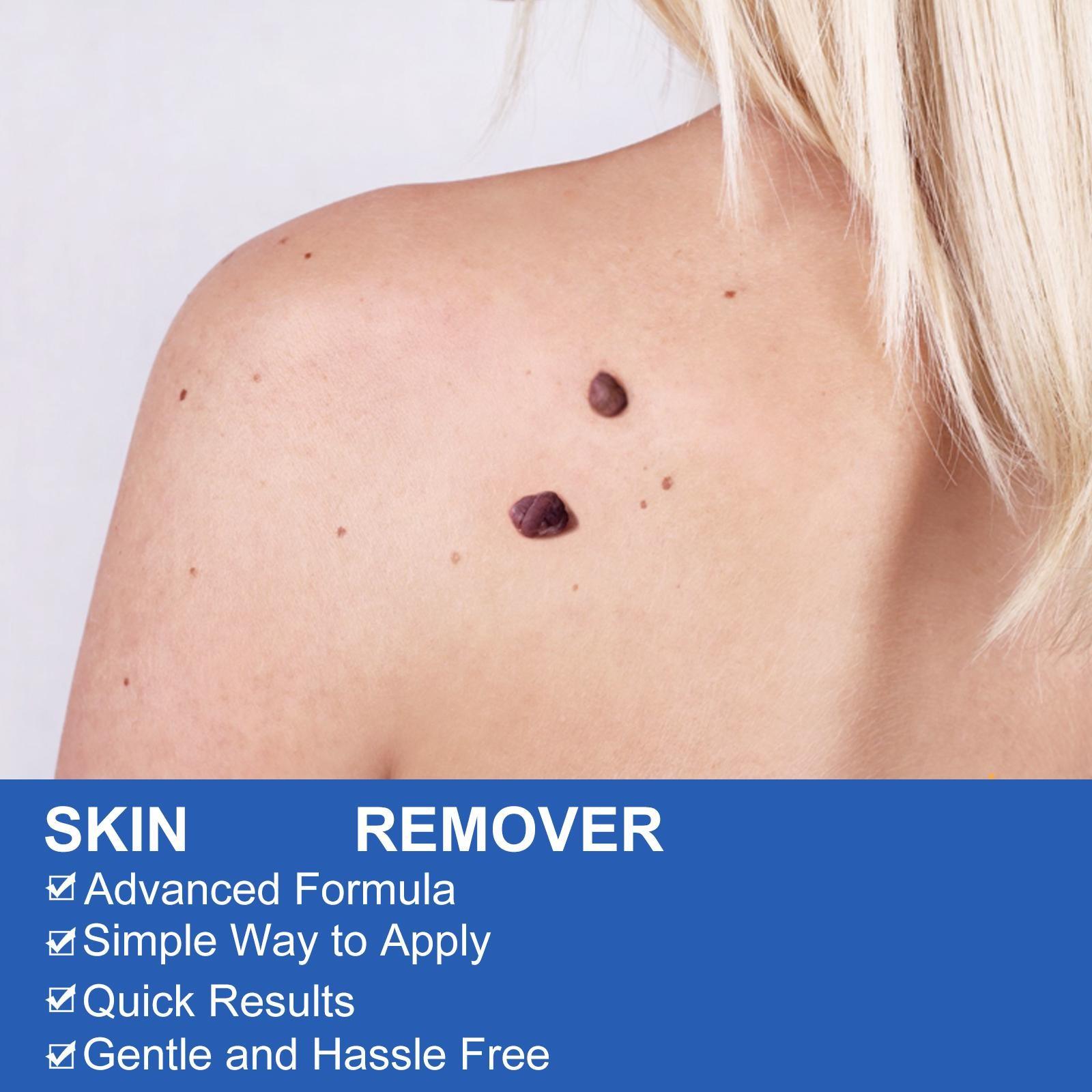 Sefudun 2-In-1 Skin Care Tool Set, Smooth Skin Kit with Safe Physical Technology, Includes Two Sizes, Rubber Bands, Wet Wipes, Protective Patches