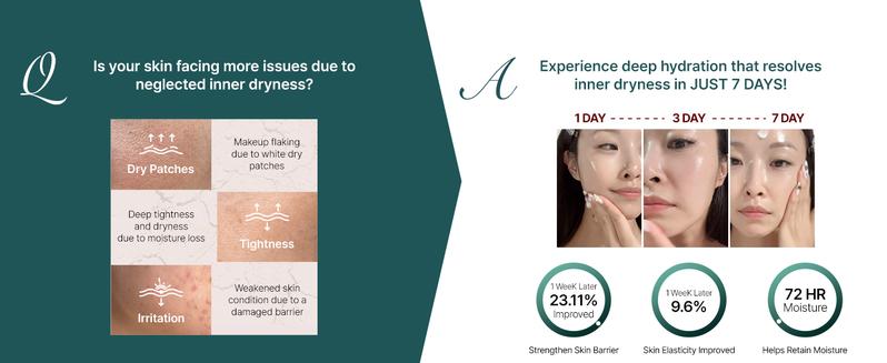 LIPOSOME REPAIR MILKY Cream, 72HR Intensive Hydration, Skin Barrier Repair with Urea 6%, Advanced Deep Penetration, Lightweight, Non-Greasy Formula for Oily & Combination Skin, 1.69 fl oz