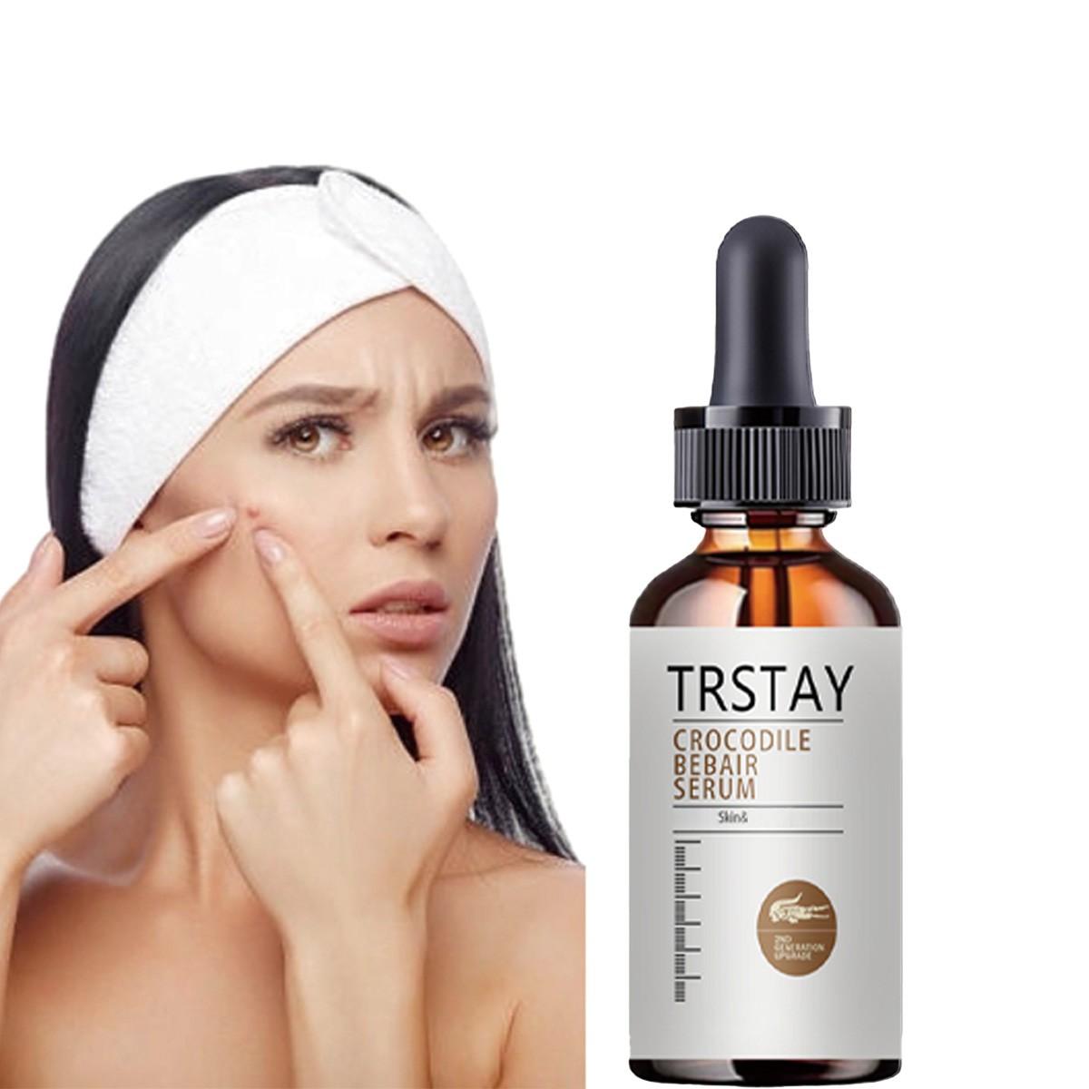 Trstay Facial Serum with Witch Hazel & Arbutin, Moisturizes, Soothes Irritated Skin, Minimizes Pores, Fades Pigmentation, Brightens Complexion