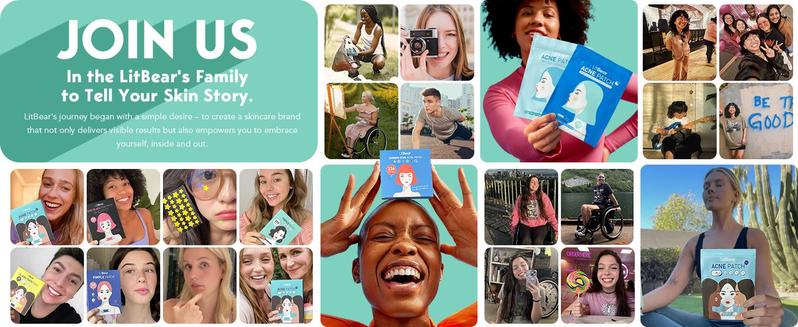 LitBear Skincare Large Pimple Patches 7 Sizes 306 Patches Acne Spot Treatment XL Hydrocolloid Bandages for Full Face Forehead Back and Body Skincare 20-00Ac-0D43-Tts2