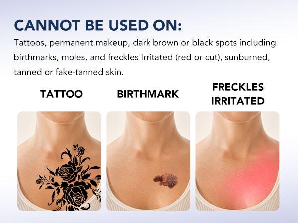 SKG Hair Freedom System, Dual-Pulse IPL for Contact-Free Hair Removal, Infinite Flashes, 25-Minute Full-Body Solution Electric Epilator Manual Epilator SKG Hair Freedom System, Dual-Pulse IPL for Contact-Free Hair Removal, Infinite Flashes, 25-Minute Full-Body Solution Electric Epilator Manual Epilator