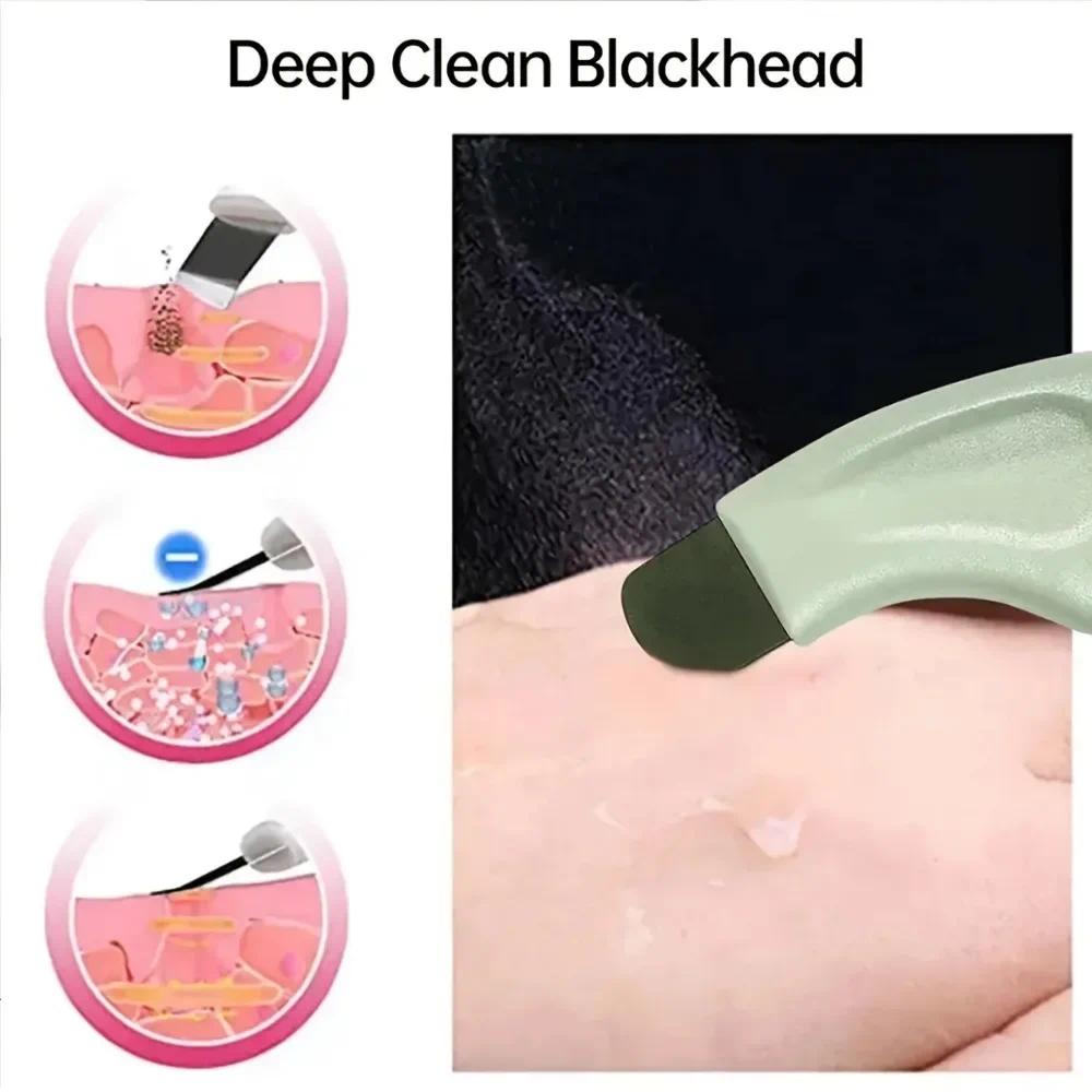 Blackhead Spatula Blackhead and Whitehead Removal Tool for Nose and Face - Facial Pore Cleaner Skin Care Tools for Women