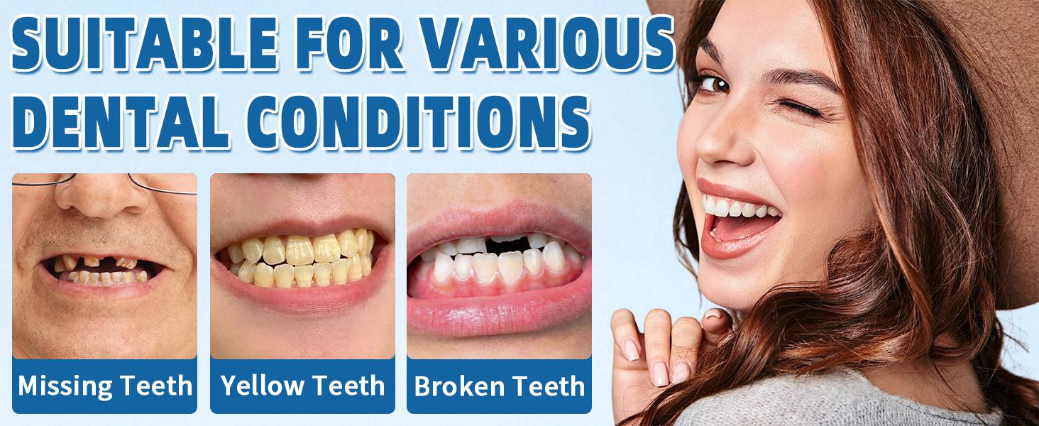 2026 Adjustable Snap-On Veneers Denture Set - Upper-Lower Teeth Covers, Natural Full Coverage Tooth Caps Kit for Adults