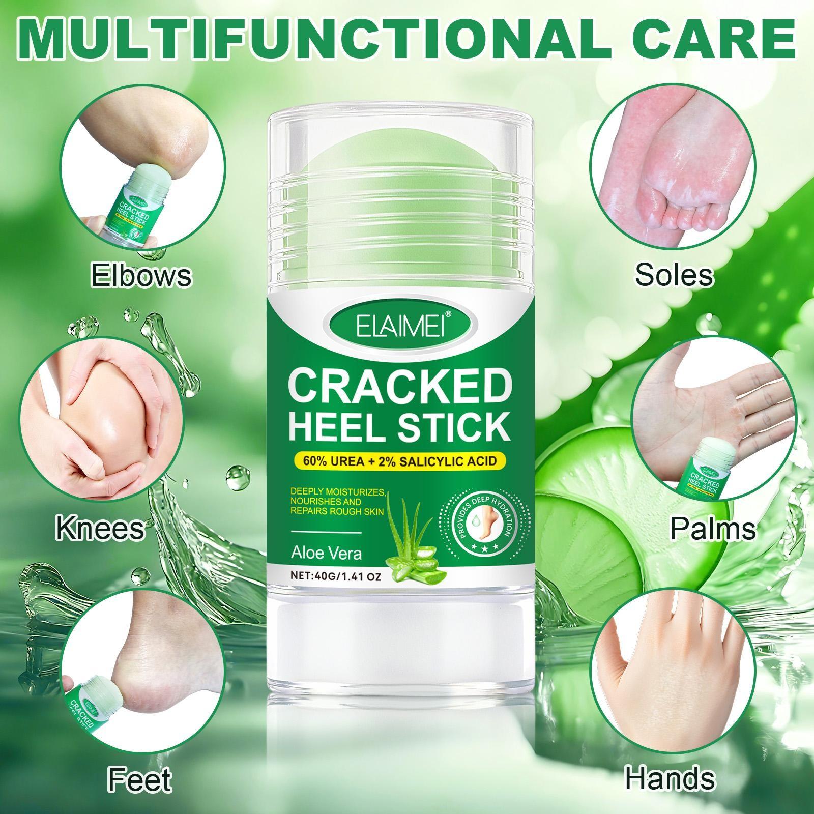 ELAIMEI Aloe Vera Skin Care Stick, containing ingredients such as urea and salicylic acid, softens rough skin, quickly moisturizes dry areas, soothes dryness, and provides long-lasting hydration.