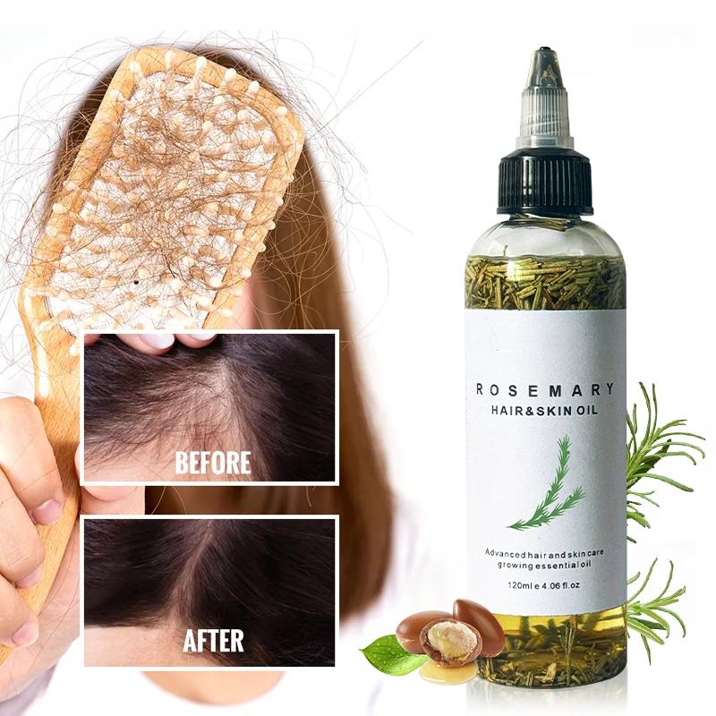 LANYAN 120ML Scalp Stimulating Hair Growth Oil, Light Mint & Peppermint Blend, Promotes Fuller Thicker Hair, Supports Hair Loss Repair