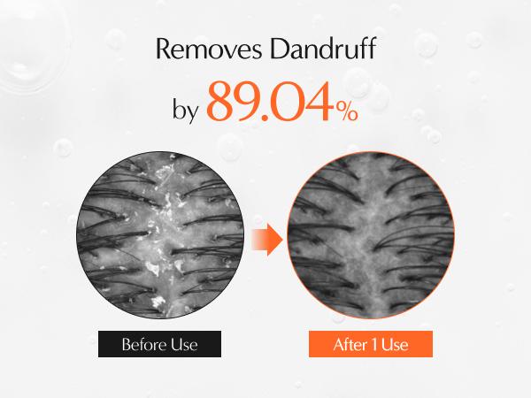 Lilyeve Growturn Hair Growth Serum with Built in Brush for Hair Growth & Thickening