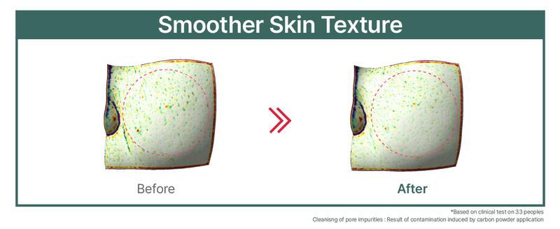 ILLIYOON Gentle Deep Triple Cleansing Set | Highly Effective Cleansing, Low-Irritation, Eye-Safe Formula, Pore Health Care, Hydrating Finish, Vegan Certified, Clean Beauty Standard (21.63 fl.oz.) ILLIYOON Gentle Deep Triple Cleansing Set | Highly Effective Cleansing, Low-Irritation, Eye-Safe Formula, Pore Health Care, Hydrating Finish, Vegan Certified, Clean Beauty Standard (21.63 fl.oz.)