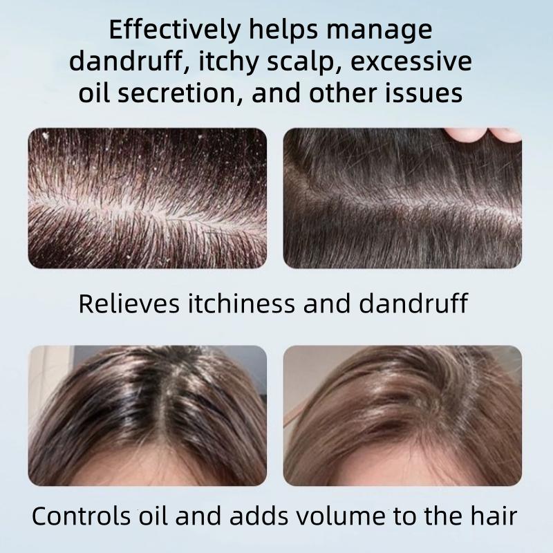 NIPPORI Selenium Disulfide Hair Care Shampoo Oil Control Refreshing Anti-Dandruff Anti-itch Scalp Cleansing Shampoo, 300ML