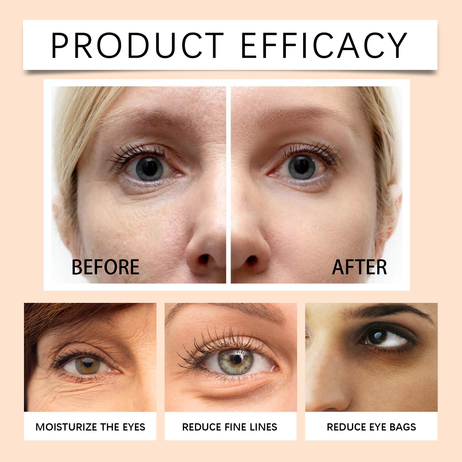 EELHOE 5 PDRN Collagen Vitalizing Hydrogel Eye Patch (60pcs) - Dark Circle Eraser & Anti-Wrinkle | 5 Types of PDRN + Vitamin C + Glutathione | ALL IN ONE EYE PATCH