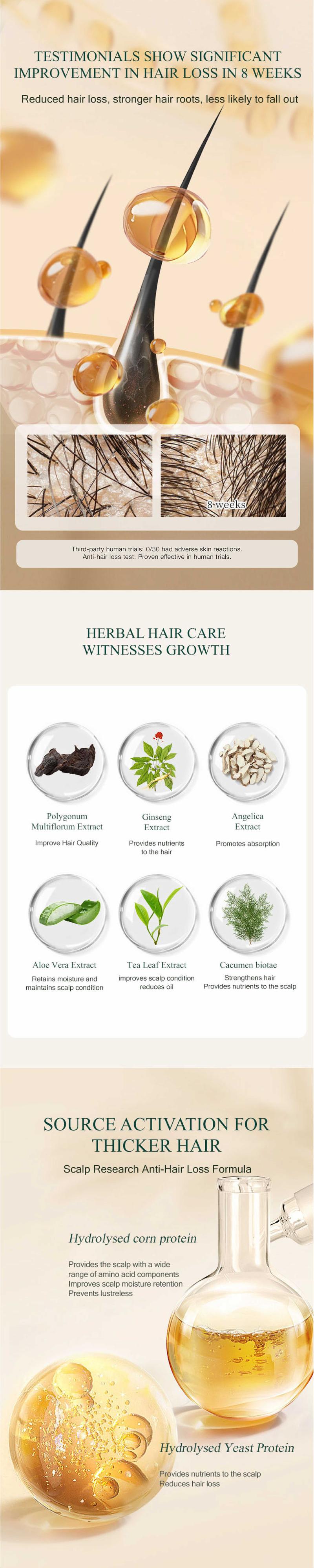 SIPIMO 【FDA】Hair Growth Essence Anti Hair Loss Liquid Promote Thick Fast Hair Growth Beauty Serum 100ml Flower Haircare Herbal Repair Spray Tonic, Ginseng & Polygonum Scalp Care Essence For Healthier, Thicker Fuller, Serum Haircare Spray tonic Comfort SIPIMO 【FDA】Hair Growth Essence Anti Hair Loss Liquid Promote Thick Fast Hair Growth Beauty Serum 100ml Flower Haircare Herbal Repair Spray Tonic, Ginseng & Polygonum Scalp Care Essence For Healthier, Thicker Fuller, Serum Haircare Spray tonic Comfort