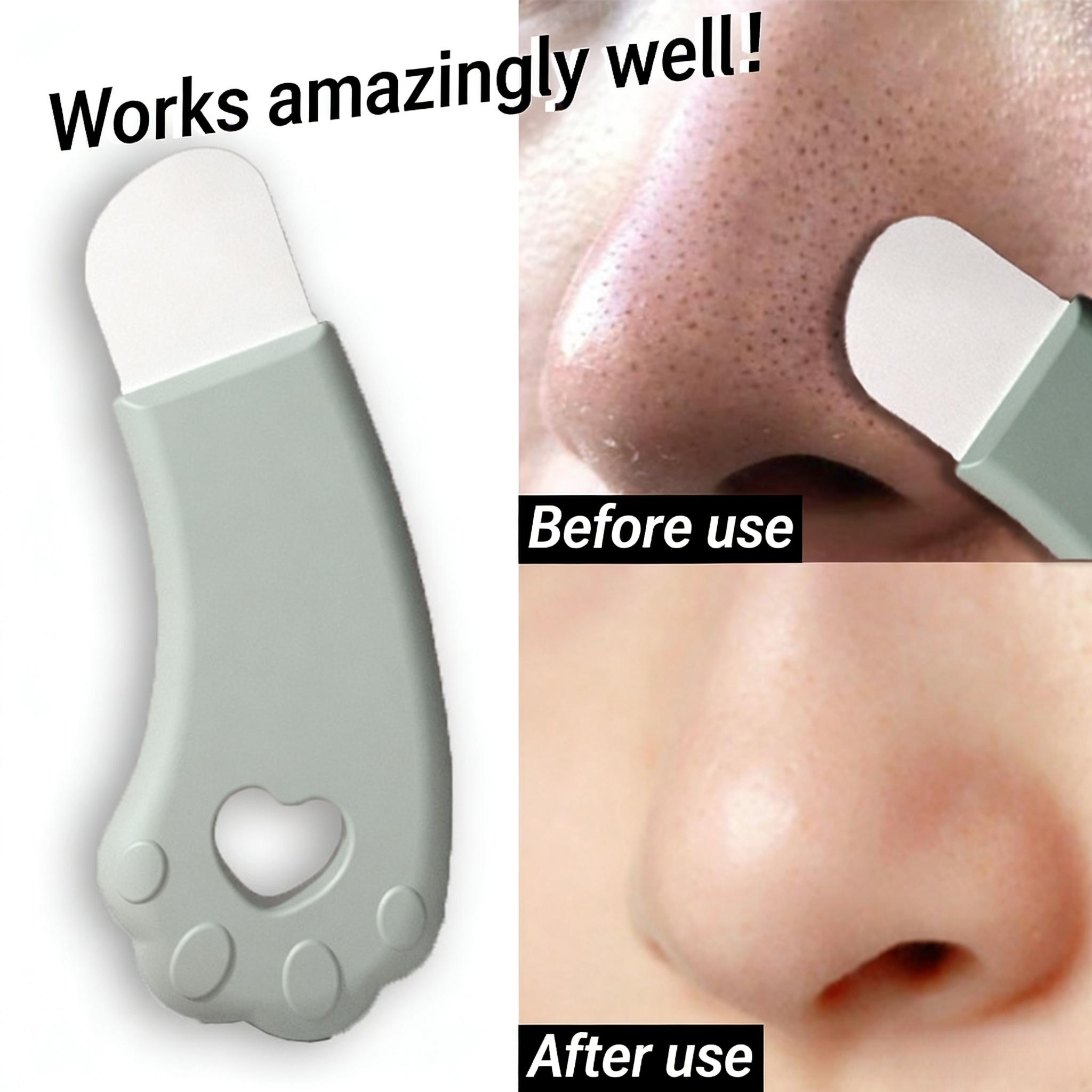 1pc Manual Blackhead Remover Scraper, Facial Pore Cleaner Tool, Blackhead Shovel & Acne Extractor