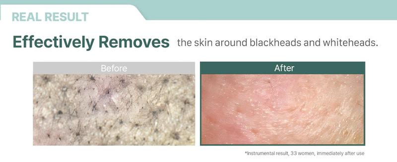 ILLIYOON Gentle Deep Cleansing Oil | Hypoallergenic & Sensitive Skin-Friendly, Lightweight yet effective without clogging pores, Fast-emulsifying formula, No greasy residue, Vegan Certified