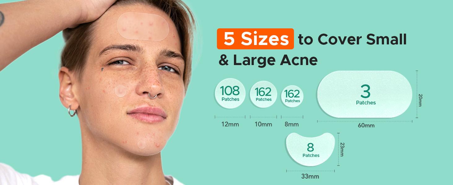 443 Count Pimple Patches for Face, Hydrocolloid Acne Patch Bulk, Acne Stickers for Covering Cheeks, Forehead, Chin Blemishes Zit Breakouts for All Skin Types (Dots, Strip, Contoured 5 Sizes) acne clearing products pimplepatches #SpringStatements