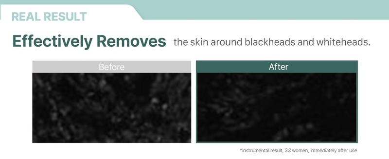 ILLIYOON Gentle Deep Cleansing Oil | Hypoallergenic & Sensitive Skin-Friendly, Lightweight yet effective without clogging pores, Fast-emulsifying formula, No greasy residue, Vegan Certified