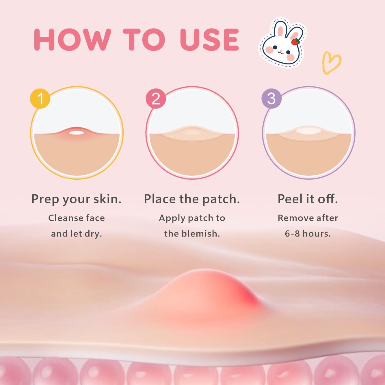 Rabbit-Shaped Acne Patches, Non-Irritating, Breathable, Makeup Covering, Alcohol-Free, Odorless, Daily Facial Care, 48/120/240 Pieces