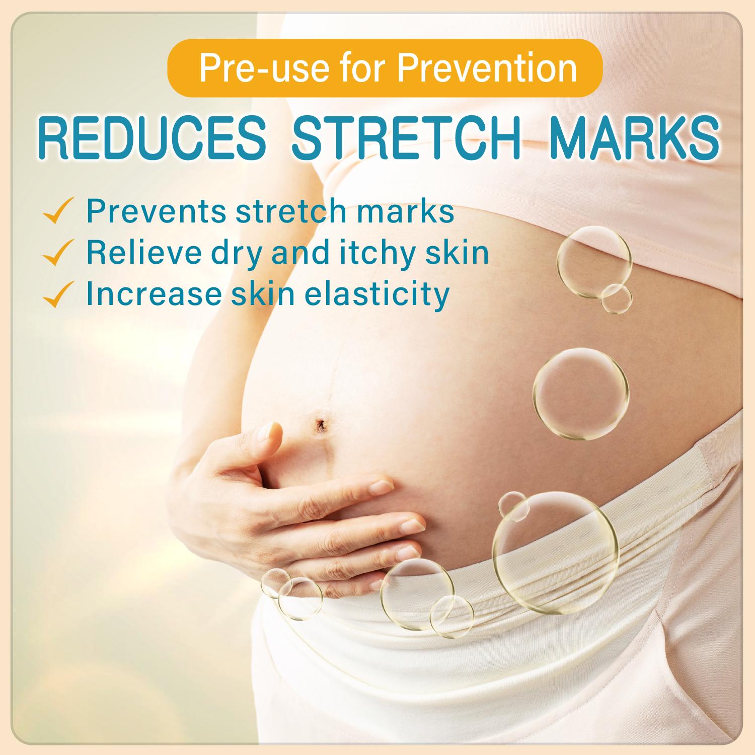 Stretch Mark Butter - Organic Belly Butter for Pregnancy and Nursing - Repair Stretch Marks and Scars - Shea Butter & Vitamin E Rich Formula, Paraben, Phenoxyethanol Free, 3.53 Oz/100g