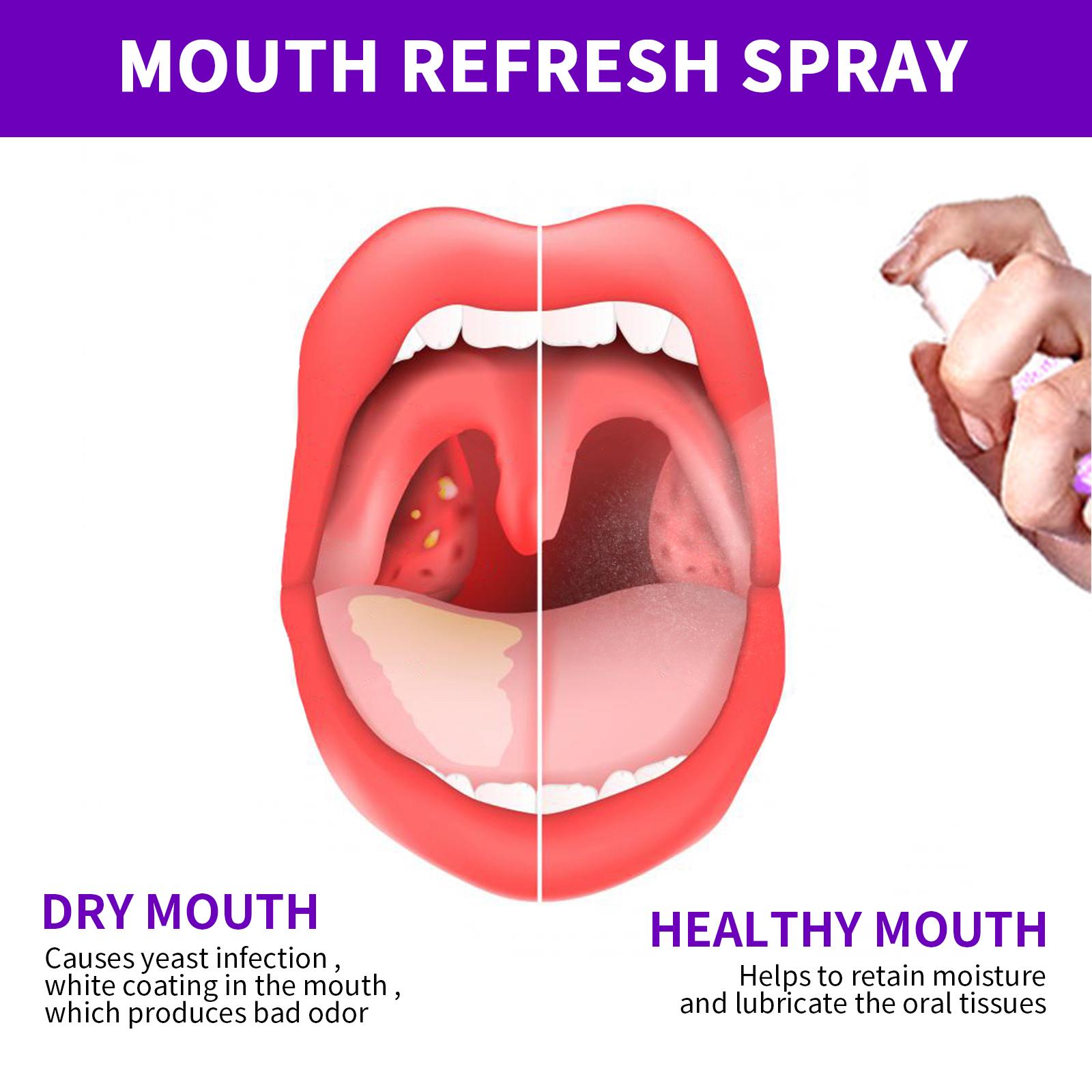 EELHOE Compact Honey Oral Spray (34g, 20ml, 3-Year Shelf Life) - Portable Mouth Freshener, Oral Cleansing & Odor Elimination Solution, Storage, Adults, Breath Oral Spray