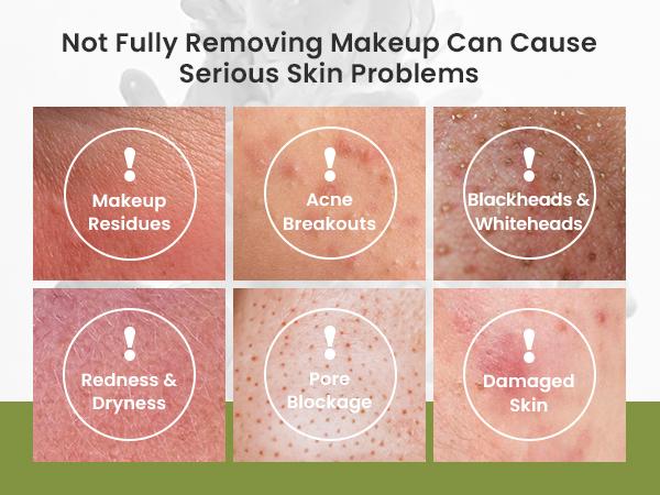 Elvira Pore Control Cleansing Oil Facial Cleanser, Daily Face Wash for Makeup & Blackhead Remover, Deep Cleansing Without Dryness, Fragrance Free & Non-Comedogenic for All Skin Types, 6.76 fl oz Facial Cleansing Comfort Skincare