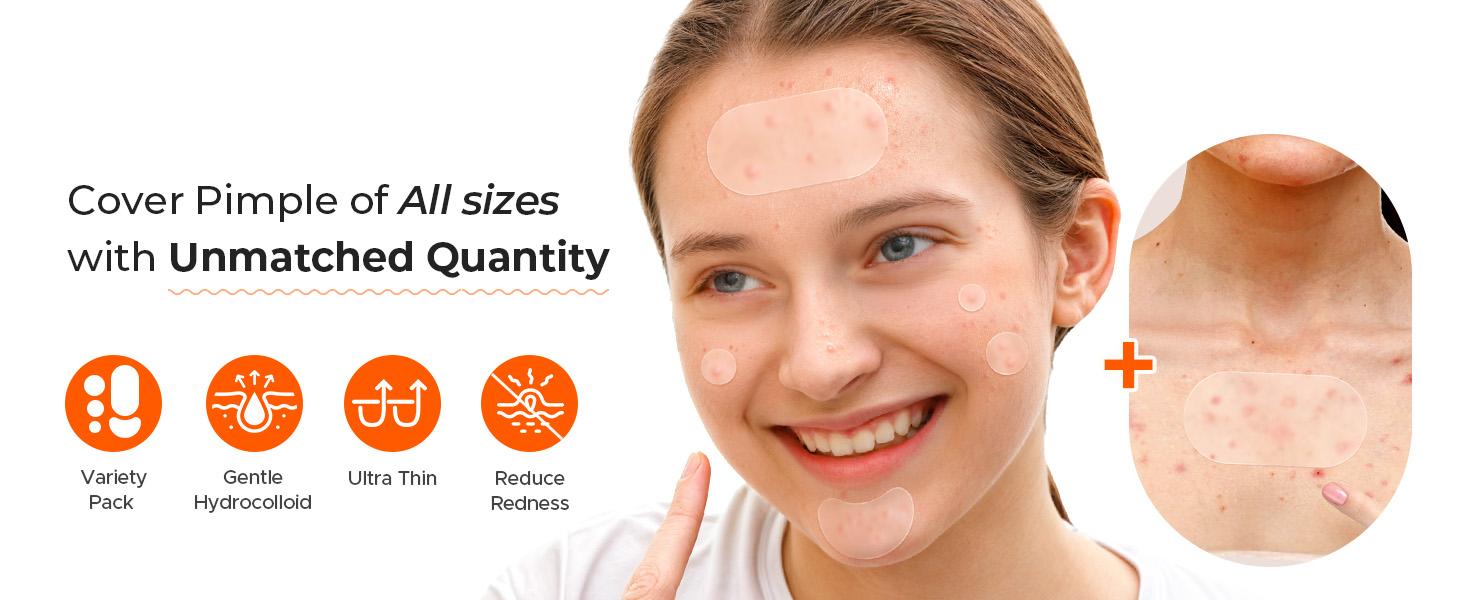 443 Count Pimple Patches for Face, Hydrocolloid Acne Patch Bulk, Acne Stickers for Covering Cheeks, Forehead, Chin Blemishes Zit Breakouts for All Skin Types (Dots, Strip, Contoured 5 Sizes) acne clearing products pimplepatches #SpringStatements