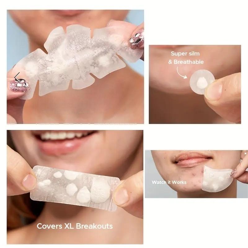 104pcs Acne Patches, Acne Pimple Patch, 5 Shapes, Hyaluronic Acid & Tea Tree Oil, Day and Night Skin Care, Transparent Gel, Anti-Acne Treatment