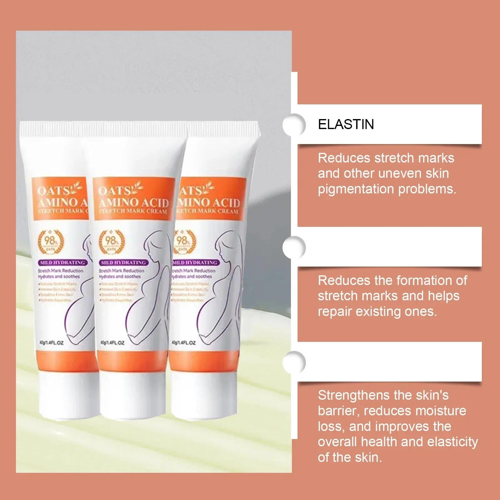 HOT SALE Stretch Marks Permanent Removal Eliminate Body Belly Stretch Marks Swelling Marks Remove Skin Cracks Repair Firming Car